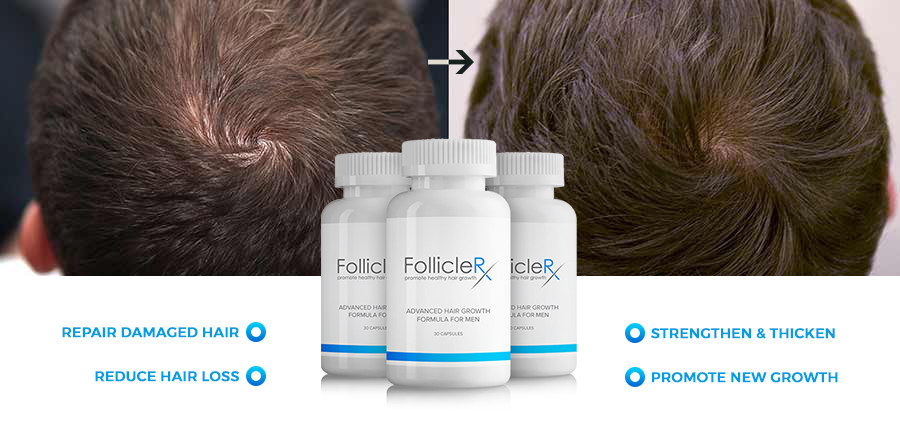 Follicle RX Regen Hair Growth - West Delhi, Delhi, India | Professional  Profile | LinkedIn